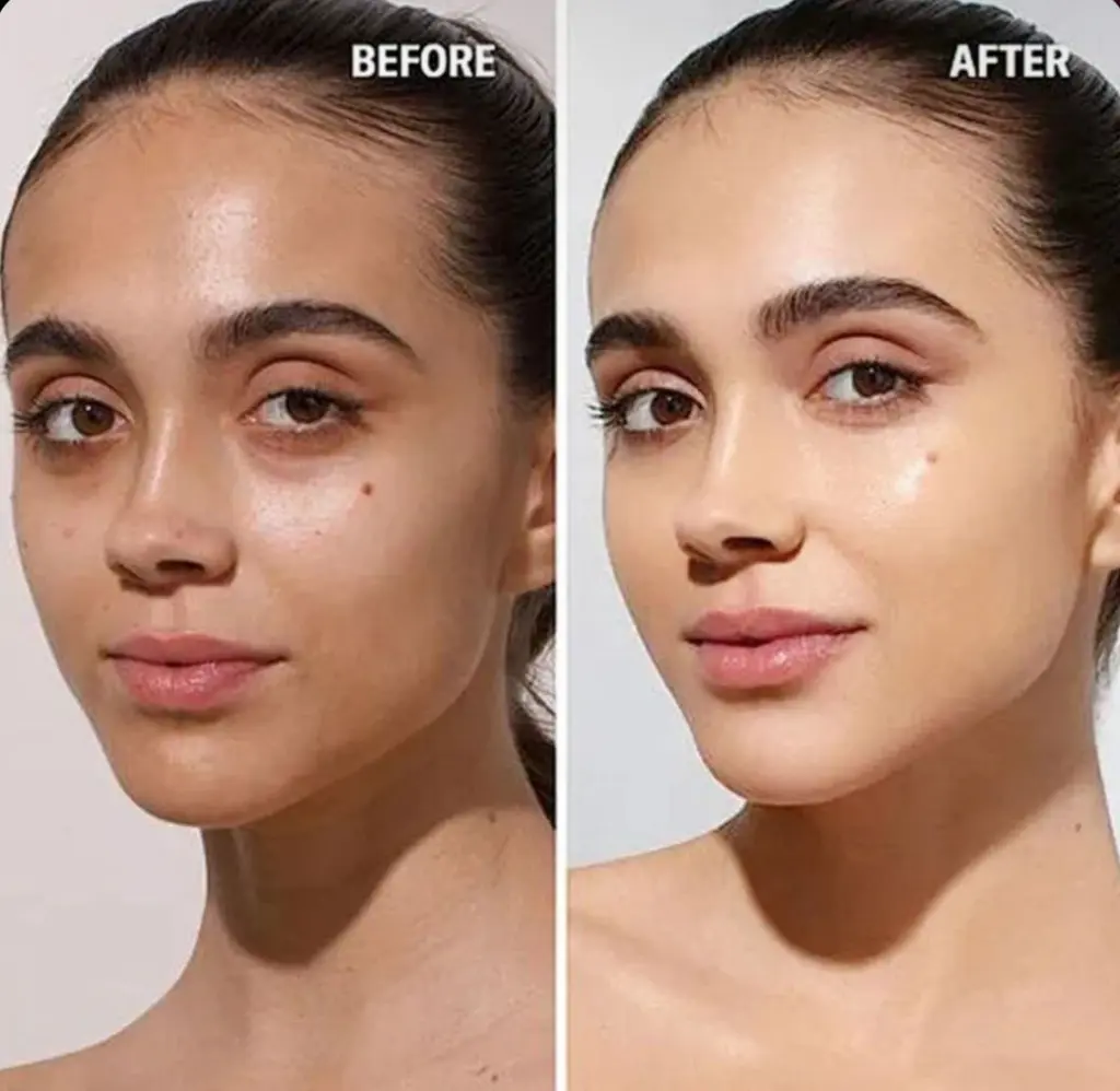 Before and after skin transformation