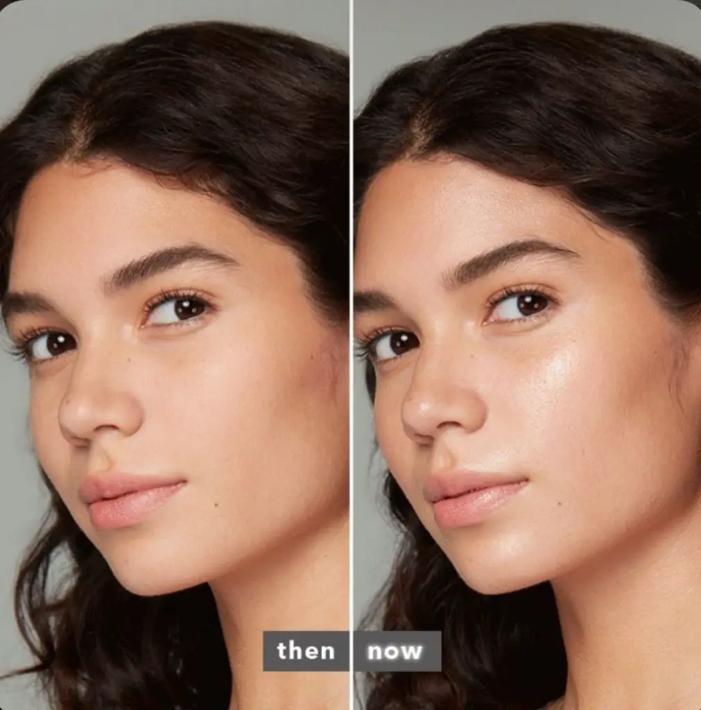 Then and now skin transformation